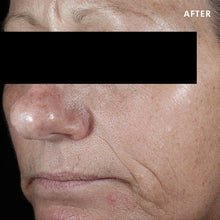 Load image into Gallery viewer, C E Ferulic®