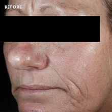 Load image into Gallery viewer, C E Ferulic®