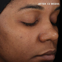 Load image into Gallery viewer, DISCOLORATION DEFENSE