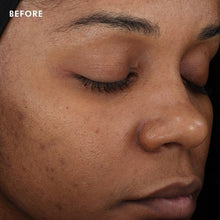 Load image into Gallery viewer, DISCOLORATION DEFENSE