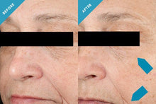 Load image into Gallery viewer, TRIPLE LIPID RESTORE 2:4:2