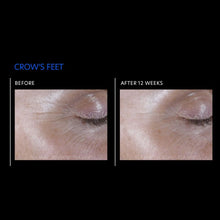 Load image into Gallery viewer, ExLinea® Pro Peptide Serum