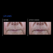 Load image into Gallery viewer, ExLinea® Pro Peptide Serum