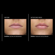 Load image into Gallery viewer, Hyaluronic Acid Lip Booster