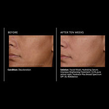 Load image into Gallery viewer, Intensive Brightening Treatment