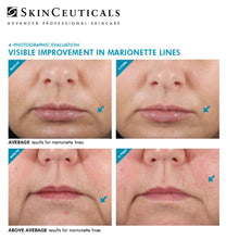 Load image into Gallery viewer, HYALURONIC ACID INTENSIFIER (H.A.)