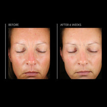 Load image into Gallery viewer, Hyaluronic Acid Overnight Mask