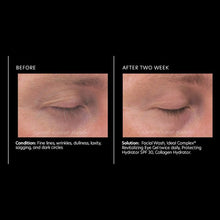 Load image into Gallery viewer, Ideal Complex® Revitalizing Eye Gel
